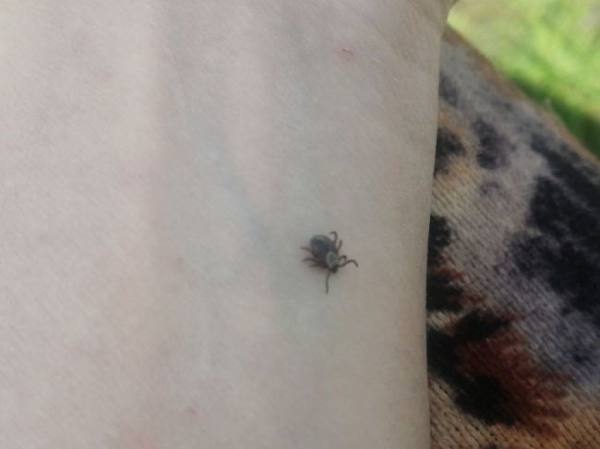 В тульском Роспотребнадзоре рассказали о профилактике клещевого энцефалита и боррелиоза летом В тульском Роспотребнадзоре рассказали о профилактике клещевого энцефалита и боррелиоза летом