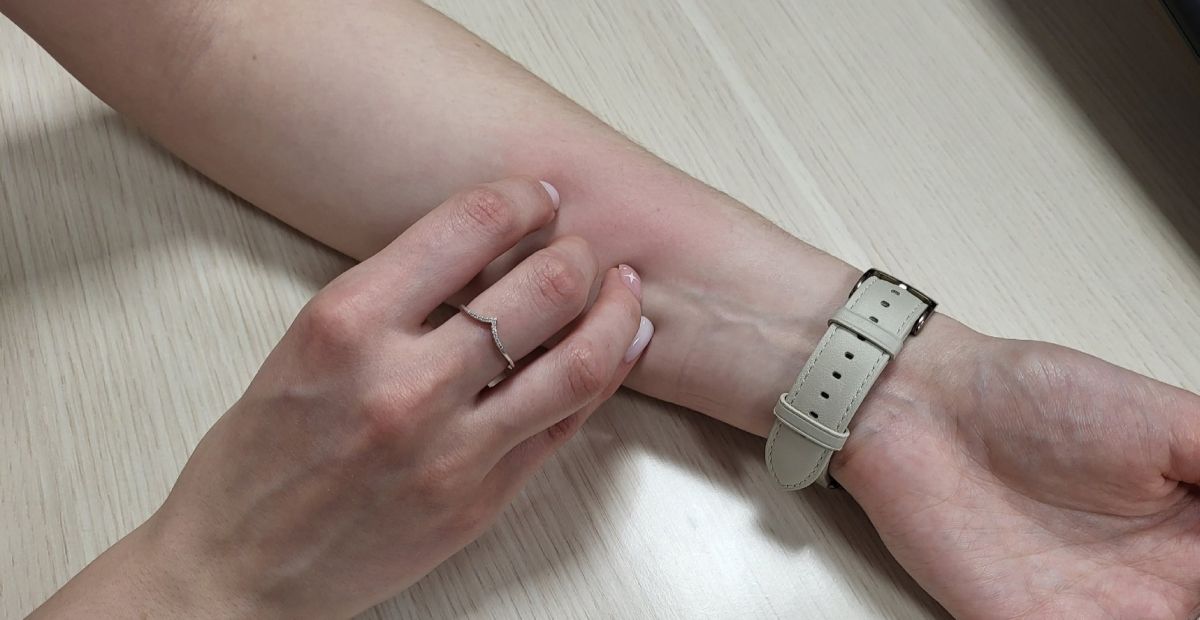 Тулякам рассказали, как провести праздники без аллергии Тулякам рассказали, как провести праздники без аллергии